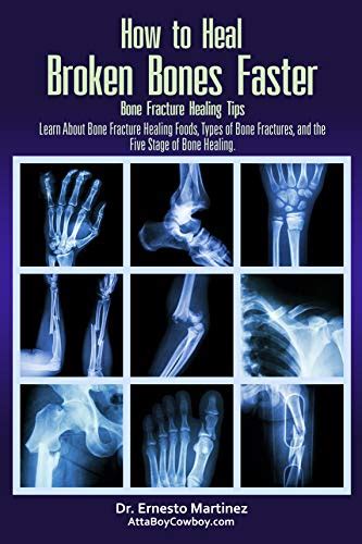 fear and hunger how to cure broken bones|ABSOLUTE BASICS .